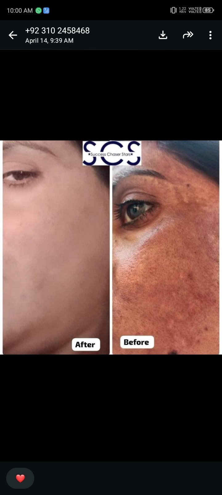 Anti-Melasma Gel